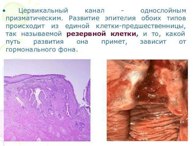 Цервикальный канал - однослойным призматическим. Развитие эпителия обоих типов происходит из