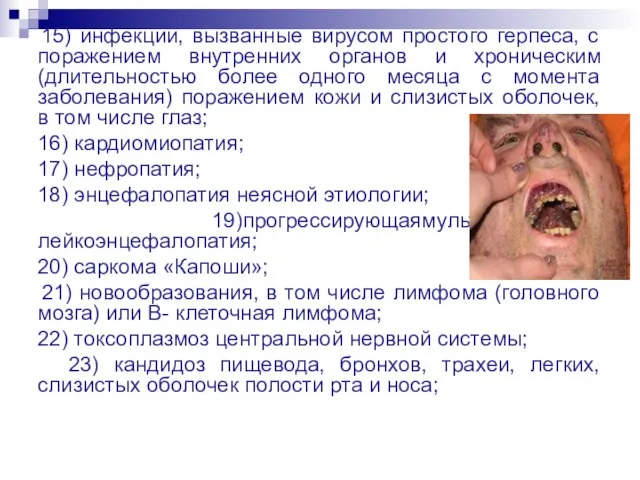 15) инфекции, вызванные вирусом простого герпеса, с поражением внутренних органов и