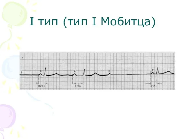 I тип (тип I Мобитца)