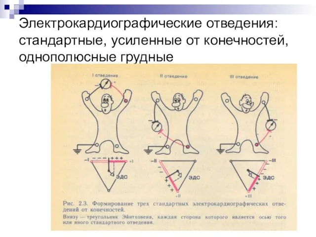 Электрокардиографические отведения: стандартные, усиленные от конечностей, однополюсные грудные