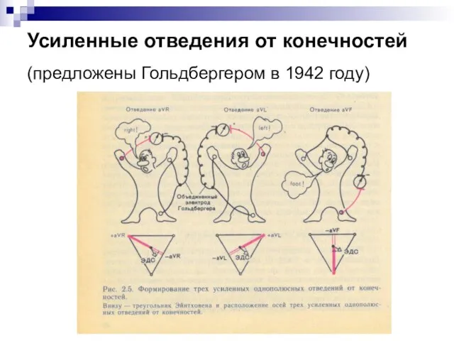 Усиленные отведения от конечностей (предложены Гольдбергером в 1942 году)