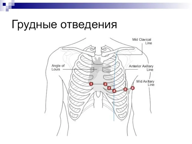 Грудные отведения