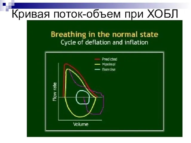 Кривая поток-объем при ХОБЛ