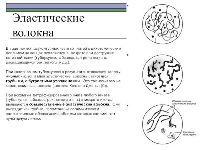 Эластические волокна В виде тонких двуконтурных извитых нитей с дихотомическим делением