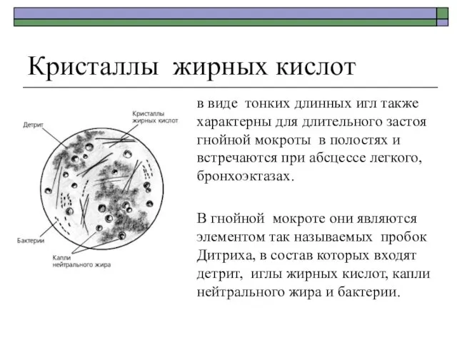 Кристаллы жирных кислот в виде тонких длинных игл также характерны для