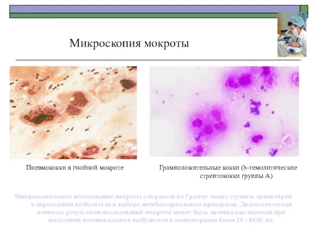 Микроскопия мокроты Пневмококки в гнойной мокроте Грамположительные кокки (b-гемолитические стрептококки группы