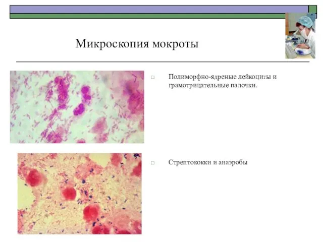 Полиморфно-ядреные лейкоциты и грамотрицательные палочки. Стрептококки и анаэробы Микроскопия мокроты