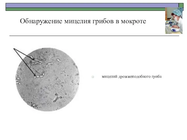 Обнаружение мицелия грибов в мокроте мицелий дрожжеподобного гриба