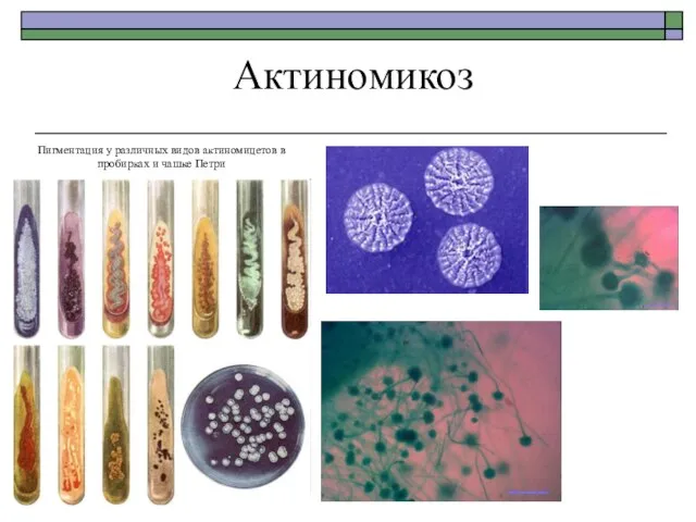 Актиномикоз Пигментация у различных видов актиномицетов в пробирках и чашке Петри