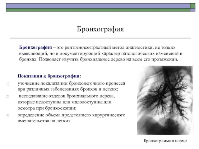 Бронхография Бронхография – это рентгеноконтрастный метод диагностики, не только выявляющий, но