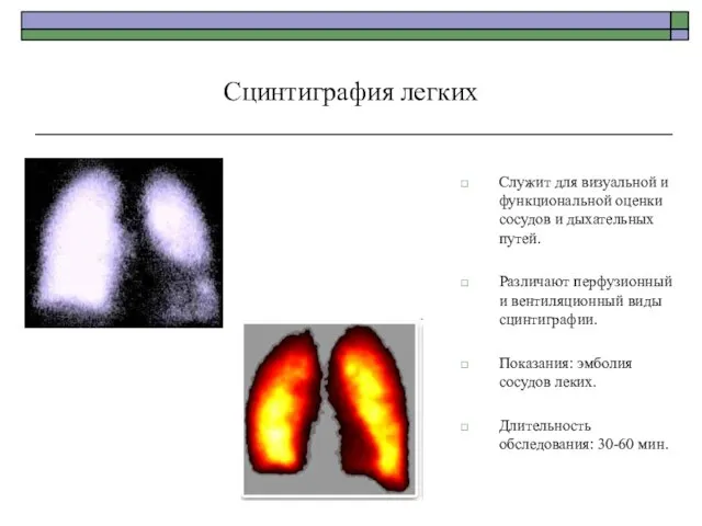 Сцинтиграфия легких Служит для визуальной и функциональной оценки сосудов и дыхательных