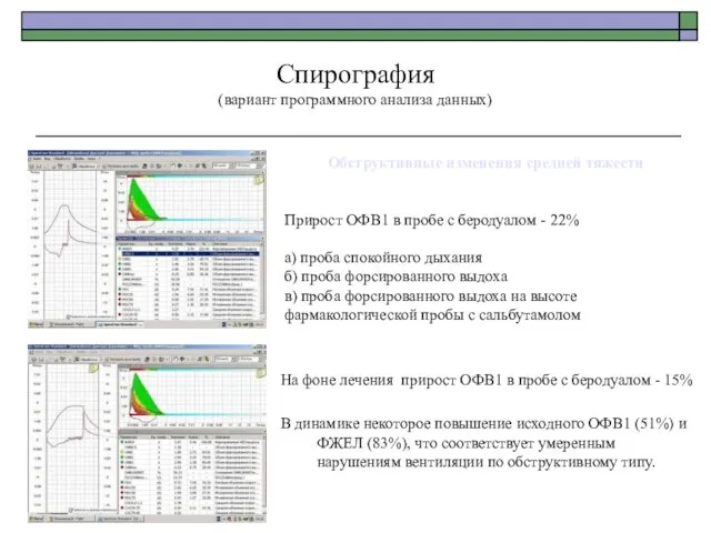 Обструктивные изменения средней тяжести Прирост ОФВ1 в пробе с беродуалом -