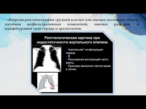 - обзорная рентгенография грудной клетки для оценки состояния лёгких, наличия инфильтративных