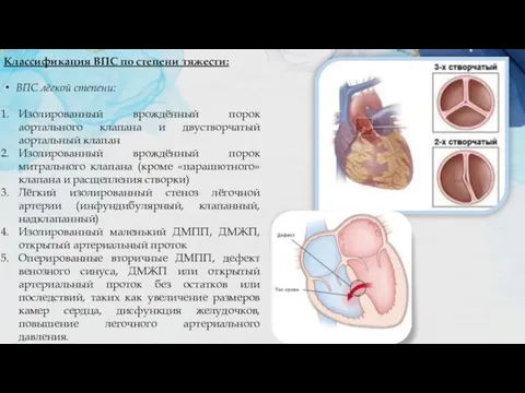 Классификация ВПС по степени тяжести: ВПС лёгкой степени: Изолированный врождённый порок