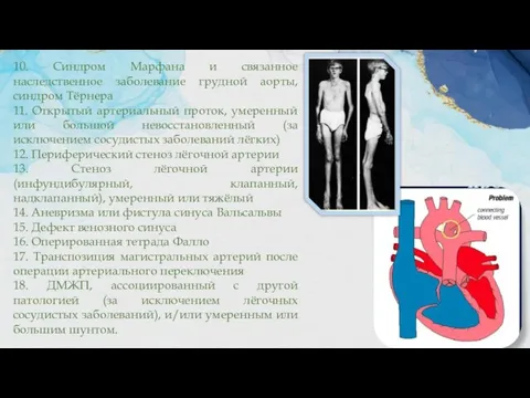 10. Синдром Марфана и связанное наследственное заболевание грудной аорты, синдром Тёрнера