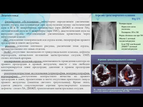 Диагностика: - физикальное обследование: перкуторно определяемое увеличение границ сердца, выслушиваемые при