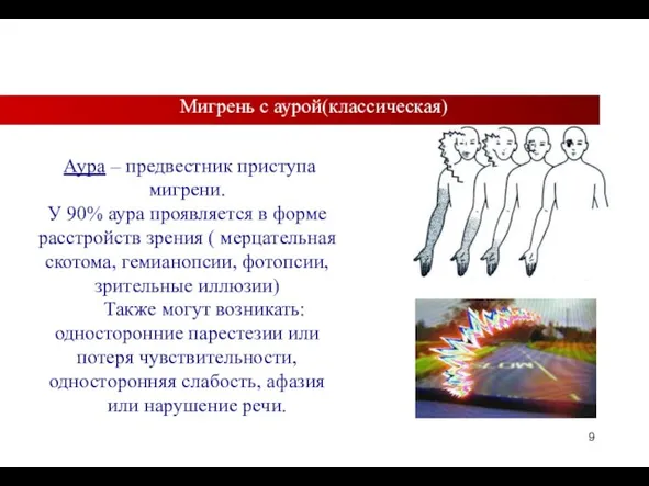 Аура – предвестник приступа мигрени. У 90% аура проявляется в форме