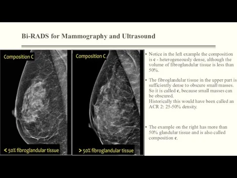 Bi-RADS for Mammography and Ultrasound Notice in the left example the