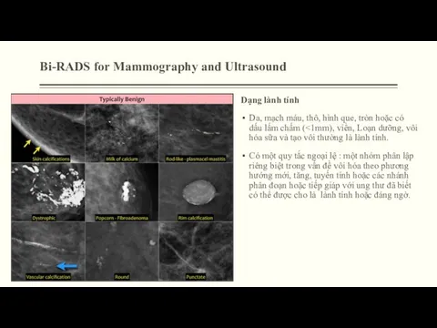 Bi-RADS for Mammography and Ultrasound Dạng lành tính Da, mạch máu,