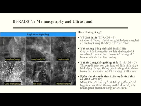 Bi-RADS for Mammography and Ultrasound Hình thái nghi ngờ: Vô định