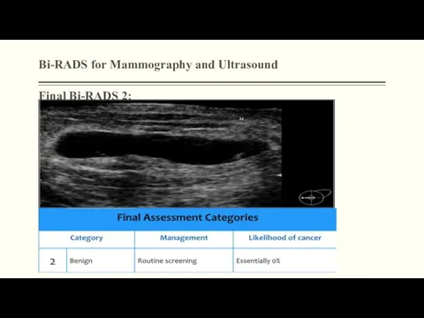 Bi-RADS for Mammography and Ultrasound Final Bi-RADS 2: