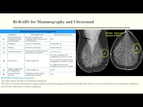 Bi-RADS for Mammography and Ultrasound BI-RADS Assessment Categories The table shows