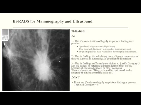 Bi-RADS for Mammography and Ultrasound BI-RADS 5 DO 1 - Use