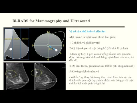 Bi-RADS for Mammography and Ultrasound Vị trí của nhũ ảnh và