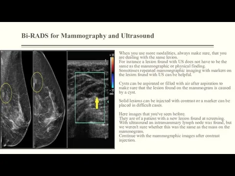 Bi-RADS for Mammography and Ultrasound When you use more modalities, always