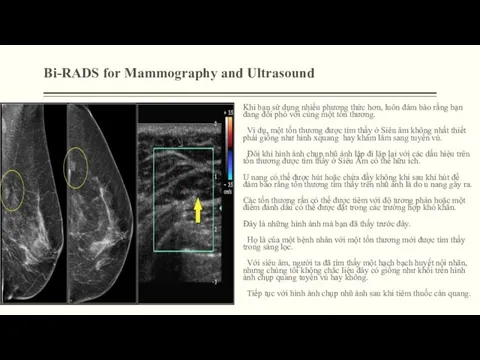 Bi-RADS for Mammography and Ultrasound Khi bạn sử dụng nhiều phương