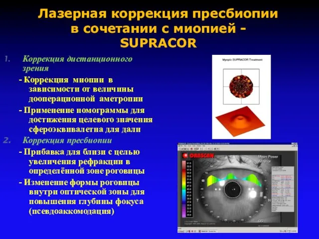 Коррекция дистанционного зрения - Коррекция миопии в зависимости от величины дооперационной