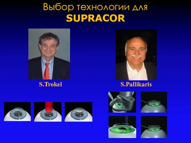 Выбор технологии для SUPRACOR S.Trokel S.Pallikaris