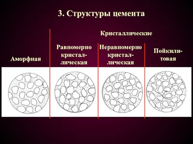 3. Структуры цемента Аморфная Равномерно кристал-лическая Пойкили-товая Кристаллические Неравномерно кристал-лическая