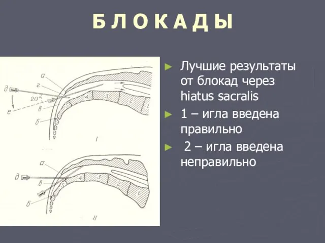 Б Л О К А Д Ы Лучшие результаты от блокад