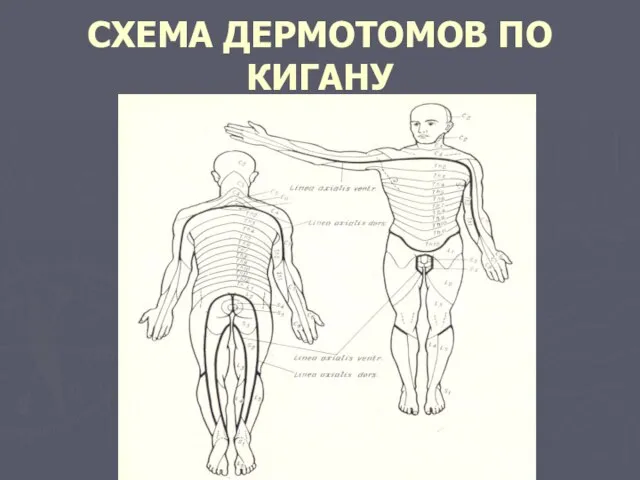 СХЕМА ДЕРМОТОМОВ ПО КИГАНУ