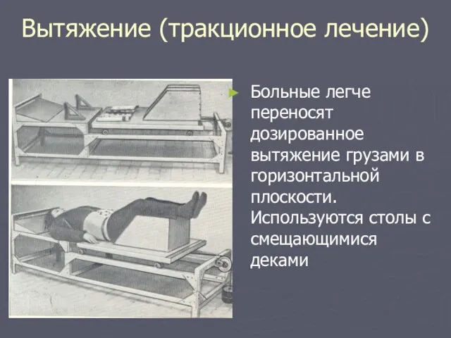 Вытяжение (тракционное лечение) Больные легче переносят дозированное вытяжение грузами в горизонтальной