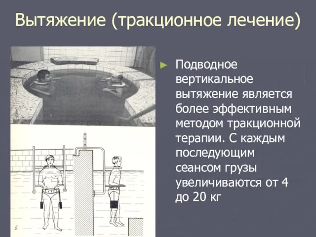 Вытяжение (тракционное лечение) Подводное вертикальное вытяжение является более эффективным методом тракционной