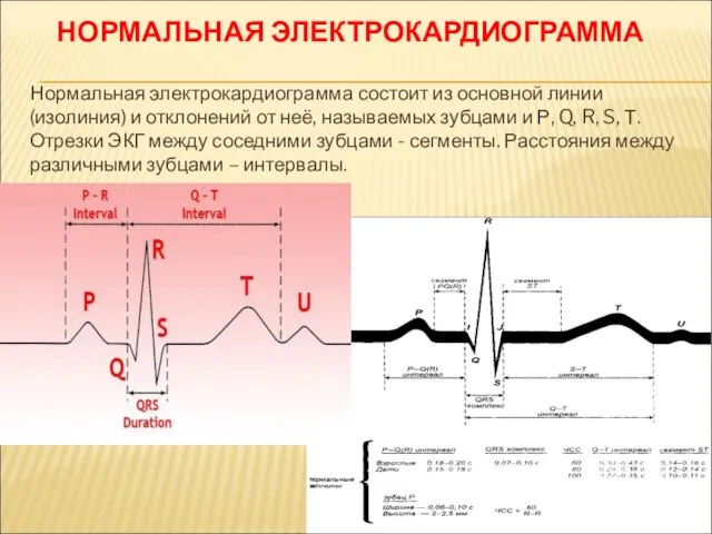 НОРМАЛЬНАЯ ЭЛЕКТРОКАРДИОГРАММА Нормальная электрокардиограмма состоит из основной линии (изолиния) и отклонений