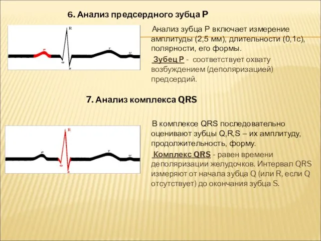 Анализ зубца Р включает измерение амплитуды (2,5 мм), длительности (0,1с), полярности,