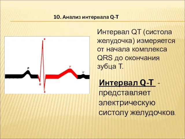 Интервал QT (систола желудочка) измеряется от начала комплекса QRS до окончания