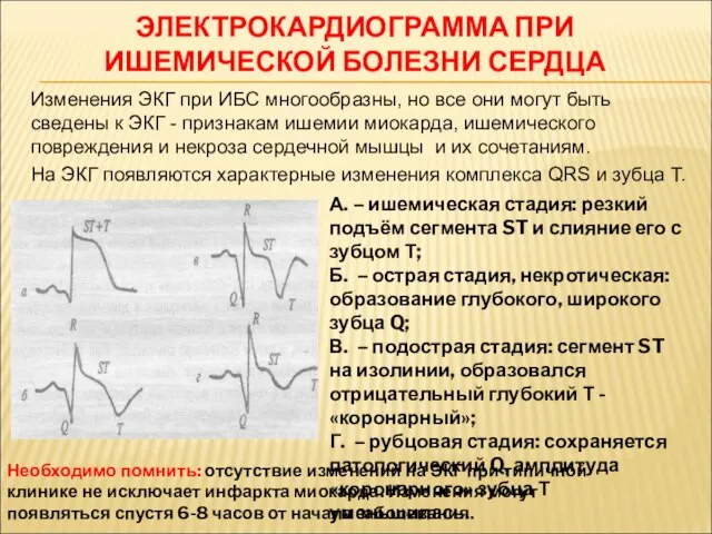 ЭЛЕКТРОКАРДИОГРАММА ПРИ ИШЕМИЧЕСКОЙ БОЛЕЗНИ СЕРДЦА Изменения ЭКГ при ИБС многообразны, но