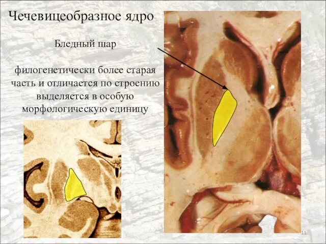 Чечевицеобразное ядро Бледный шар филогенетически более старая часть и отличается по