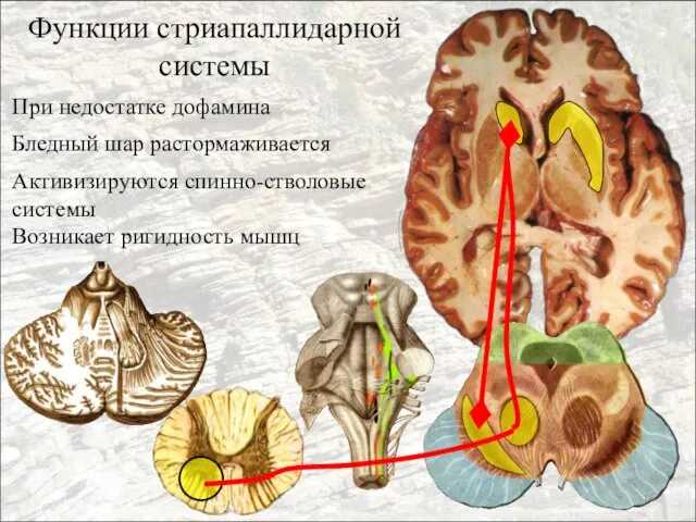 Функции стриапаллидарной системы При недостатке дофамина Бледный шар растормаживается Активизируются спинно-стволовые системы Возникает ригидность мышц