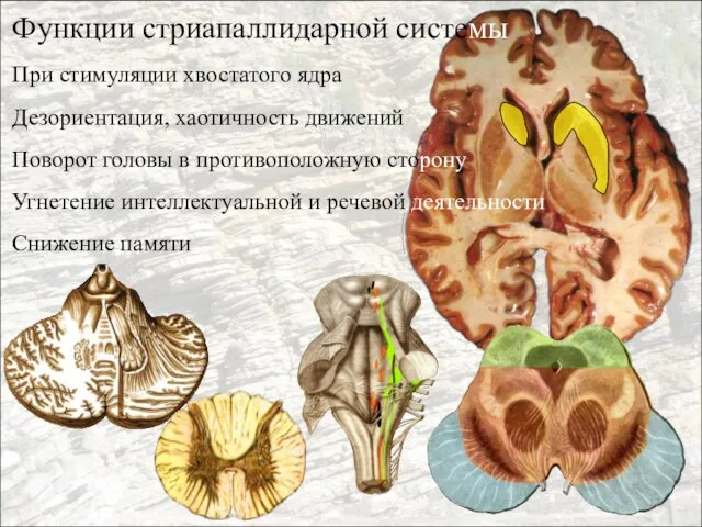 Функции стриапаллидарной системы При стимуляции хвостатого ядра Дезориентация, хаотичность движений Поворот