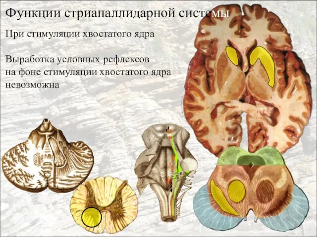 Функции стриапаллидарной системы При стимуляции хвостатого ядра Выработка условных рефлексов на фоне стимуляции хвостатого ядра невозможна