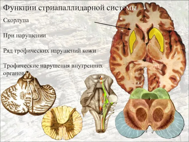 Функции стриапаллидарной системы Скорлупа При нарушении Ряд трофических нарушений кожи Трофические нарушения внутренних органов