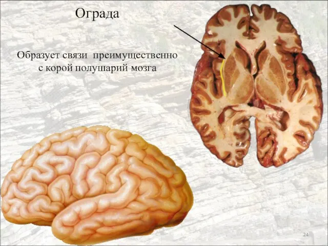 Ограда Образует связи преимущественно с корой полушарий мозга