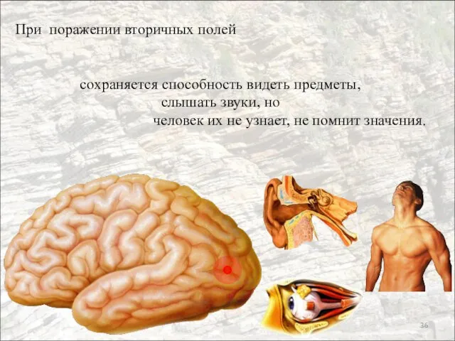 При поражении вторичных полей сохраняется способность видеть предметы, слышать звуки, но