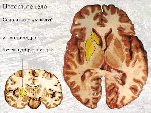 Полосатое тело Состоит из двух частей Хвостатое ядро Чечевицеобразное ядро