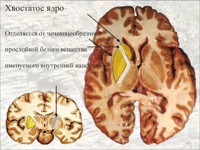 Хвостатое ядро Отделяется от чечевицеобразного прослойкой белого вещества именуемого внутренней капсулой